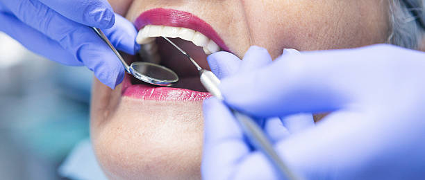 Best Emergency Tooth Extraction in Buena Vista, GA