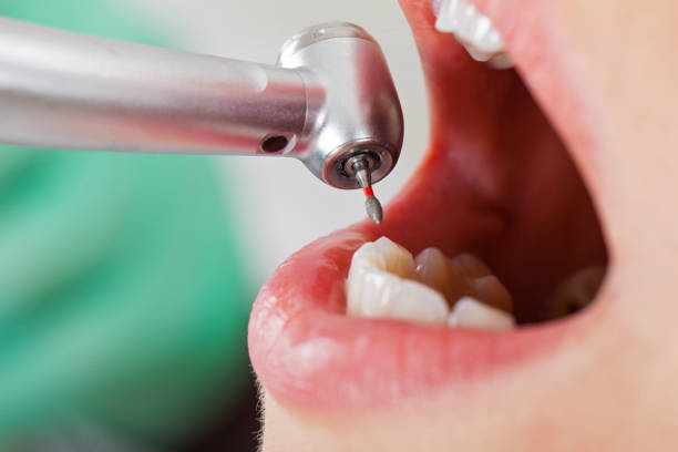 Best Emergency Treatment for Toothache in Buena Vista, GA
